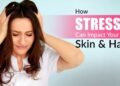 Stress and Skin Problems, Stress Hair Loss, Cortisol Effect on Skin, Skin Barrier Repair, Dermapuritys, Telogen Effluvium, Holistic Dermatology